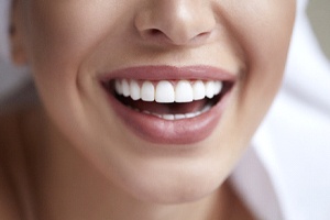 Close-up of woman’s beautiful teeth after dental bonding appointment