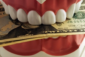 Close-up of dental model with money between teeth