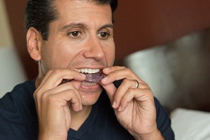Man placing sleep apnea oral appliance