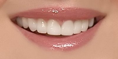 Closeup of Kim's beautiful smile after porcelain veneers and dental crowns