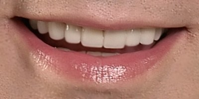 Closeup of Michael's smile with healthy teeth after smile makeover