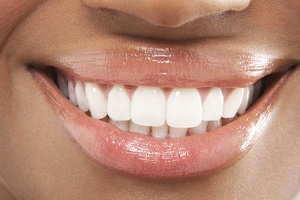 Close-up of female patient’s smile with attractive gumline