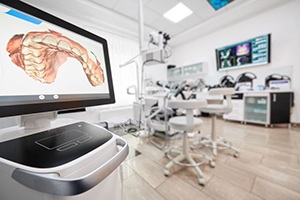 Dental scan displayed on monitor in dentist’s office