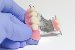 Gloved hand holding partial denture with metal attachments