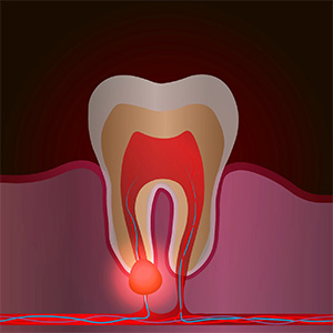Animated inside of a healthy tooth that does not require root canal therapy