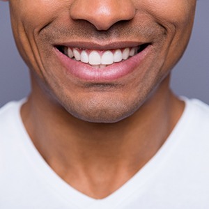 Man’s healthy smile after full mouth reconstruction in Belmont?