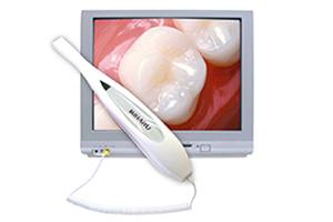 Intraoral camera tool and tooth images on computer screen
