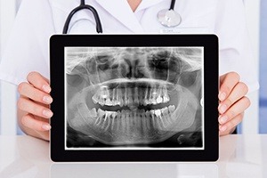 Digital x-rays on tablet computer