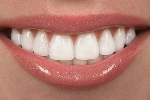 Close-up of woman’s beautiful smile with porcelain veneers
