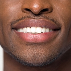 Man’s attractive smile with porcelain veneers in Belmont