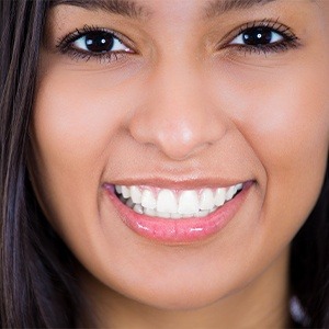 Woman sharing gorgeous smile after teeth whitening