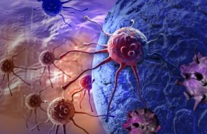 Illustration of cancer cells attacking healthy human tissues