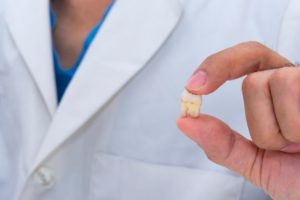 Dentist holding extracted tooth between thumb and forefinger